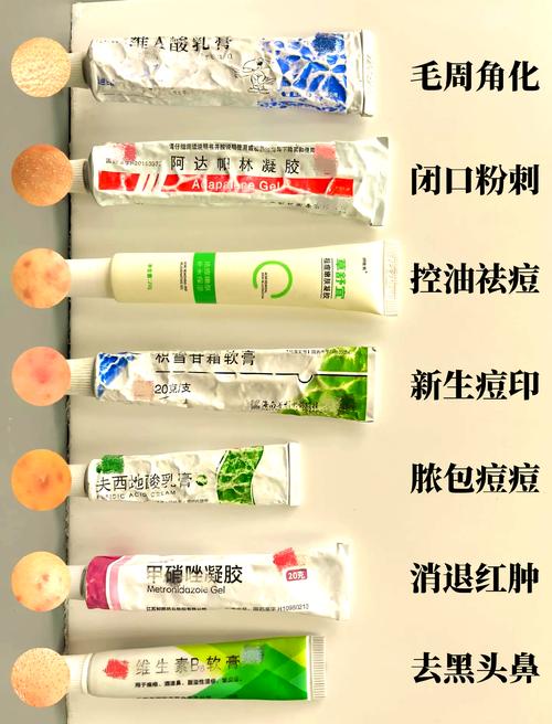 去痘印用什么比较好