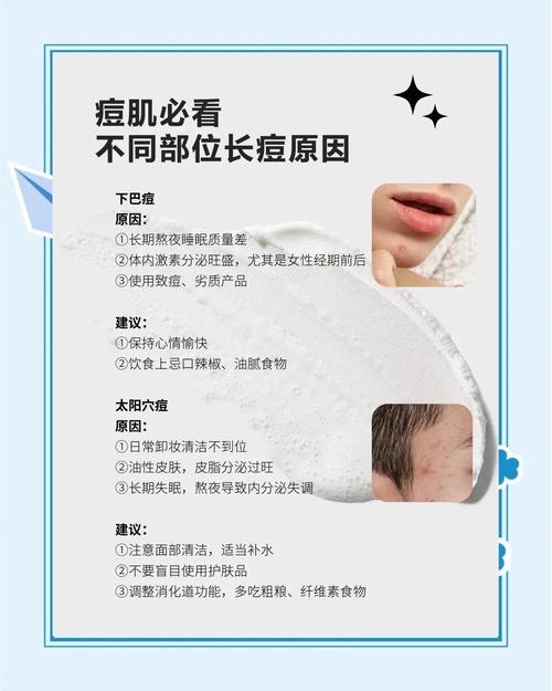 眉头长痘是什么原因