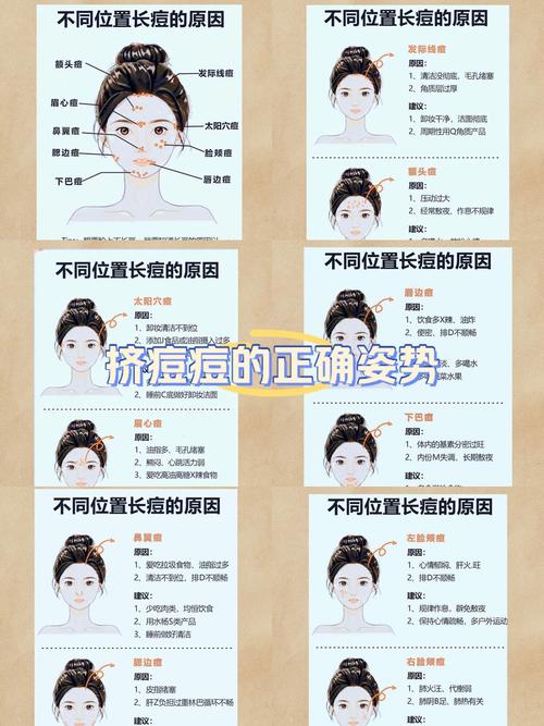 眉头长痘是什么原因