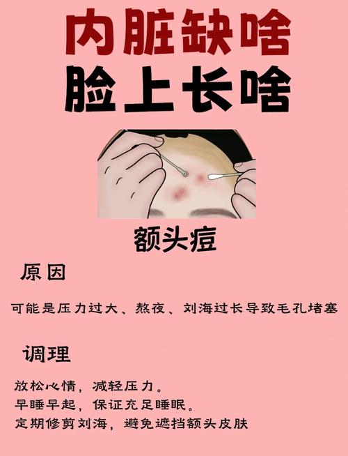 眉头长痘是什么原因