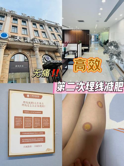 埋线减肥需要什么要求