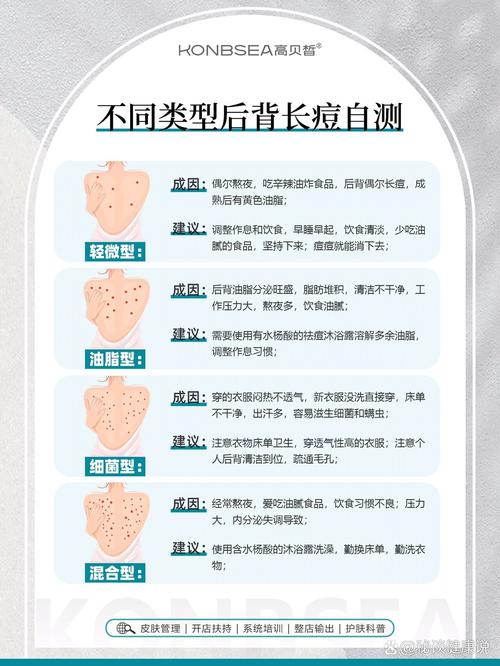 背后为什么长痘痘