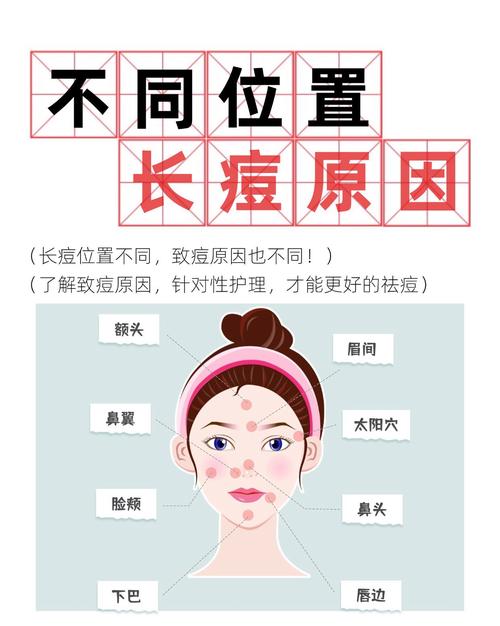 身上长痘什么原因