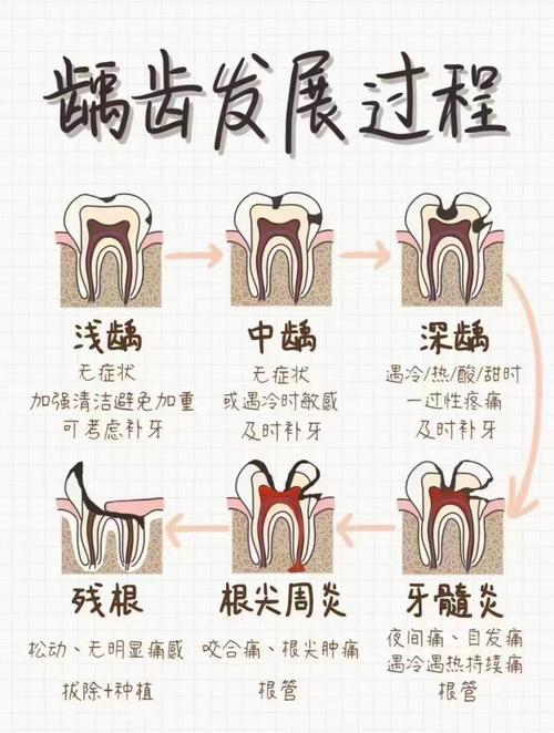 补牙后为什么会疼