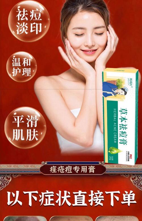 脸上长痘痘涂什么药