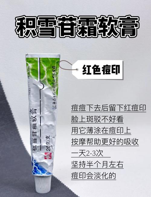 脸上长痘痘涂什么药