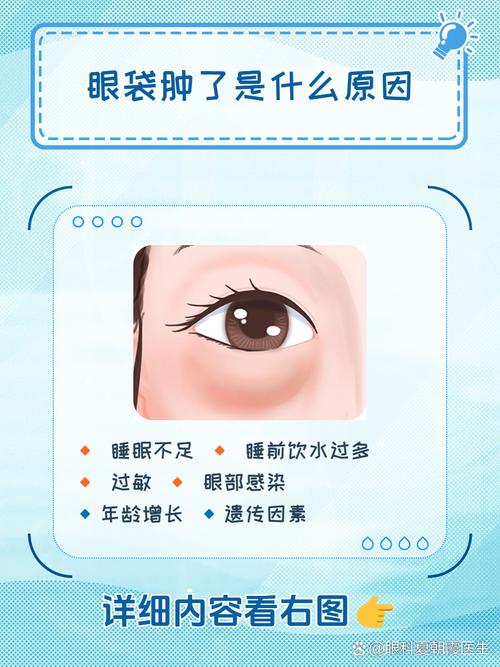 眼袋水肿是什么原因