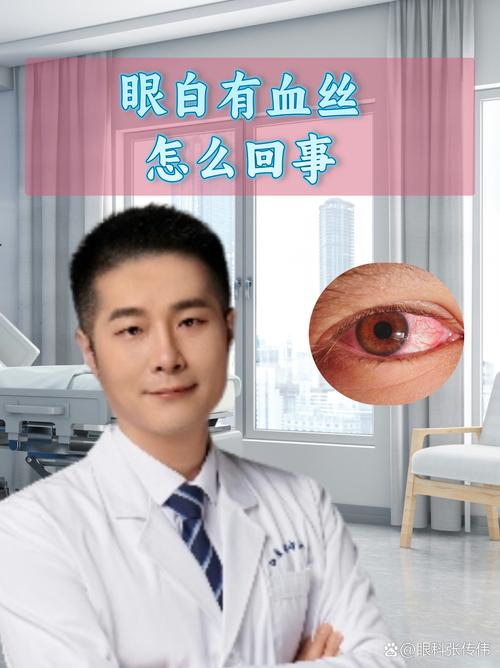 眼白充血是什么原因