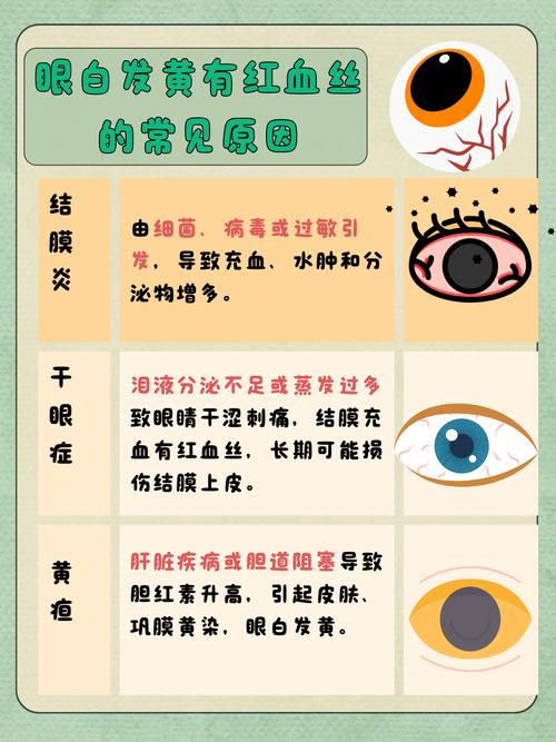眼白充血是什么原因