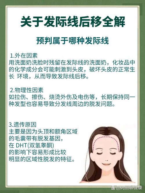 发际线后移什么原因