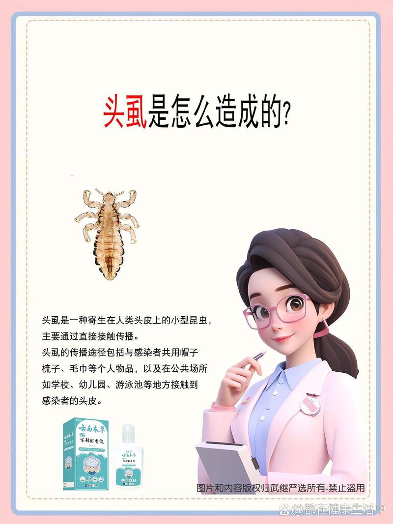 为什么头发长虱子