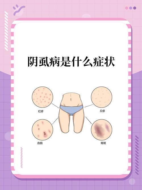 什么原因导致阴虱