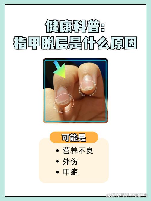 指甲脱落看什么科