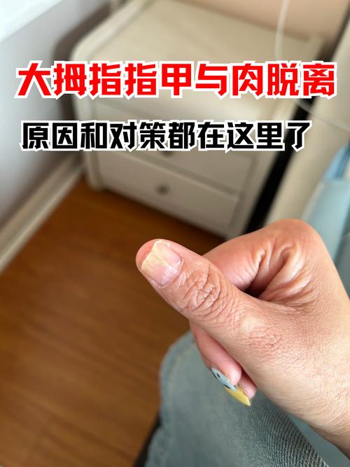 指甲脱落看什么科