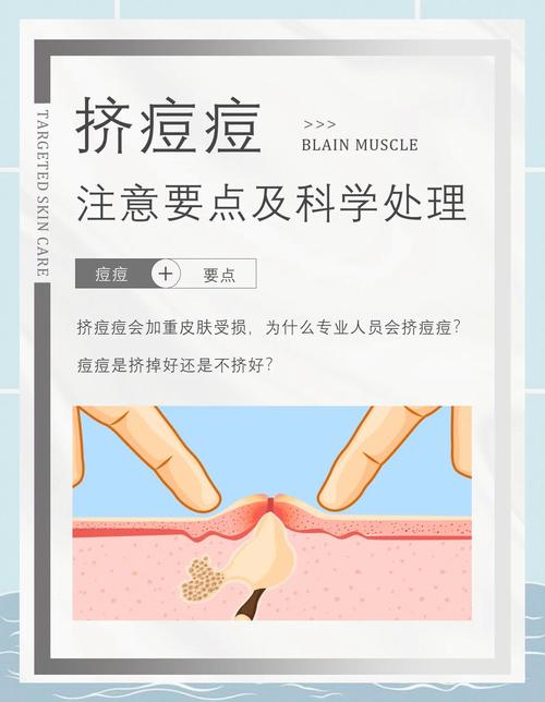 挤痘痘有什么危害