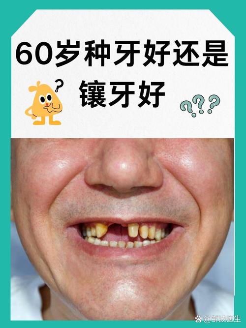 牙齿松动是缺什么
