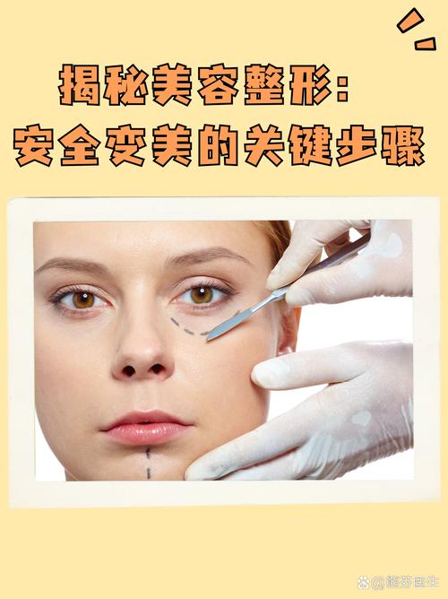 整容有什么好处