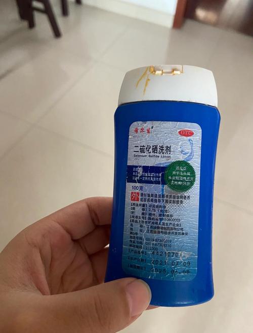 用什么可以去头皮屑