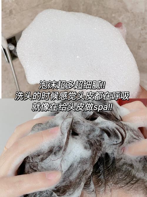 用什么可以去头皮屑
