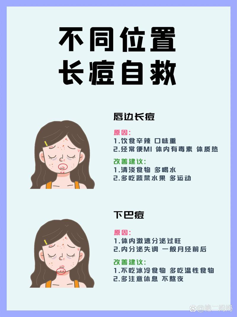 经常长痘痘是什么原因