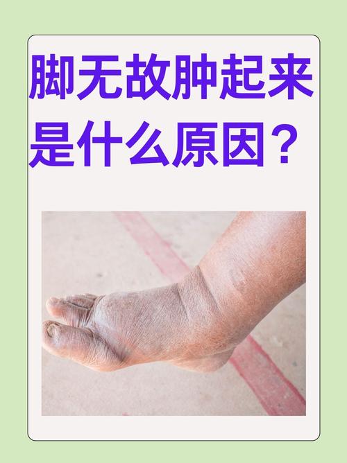 单脚肿是什么原因
