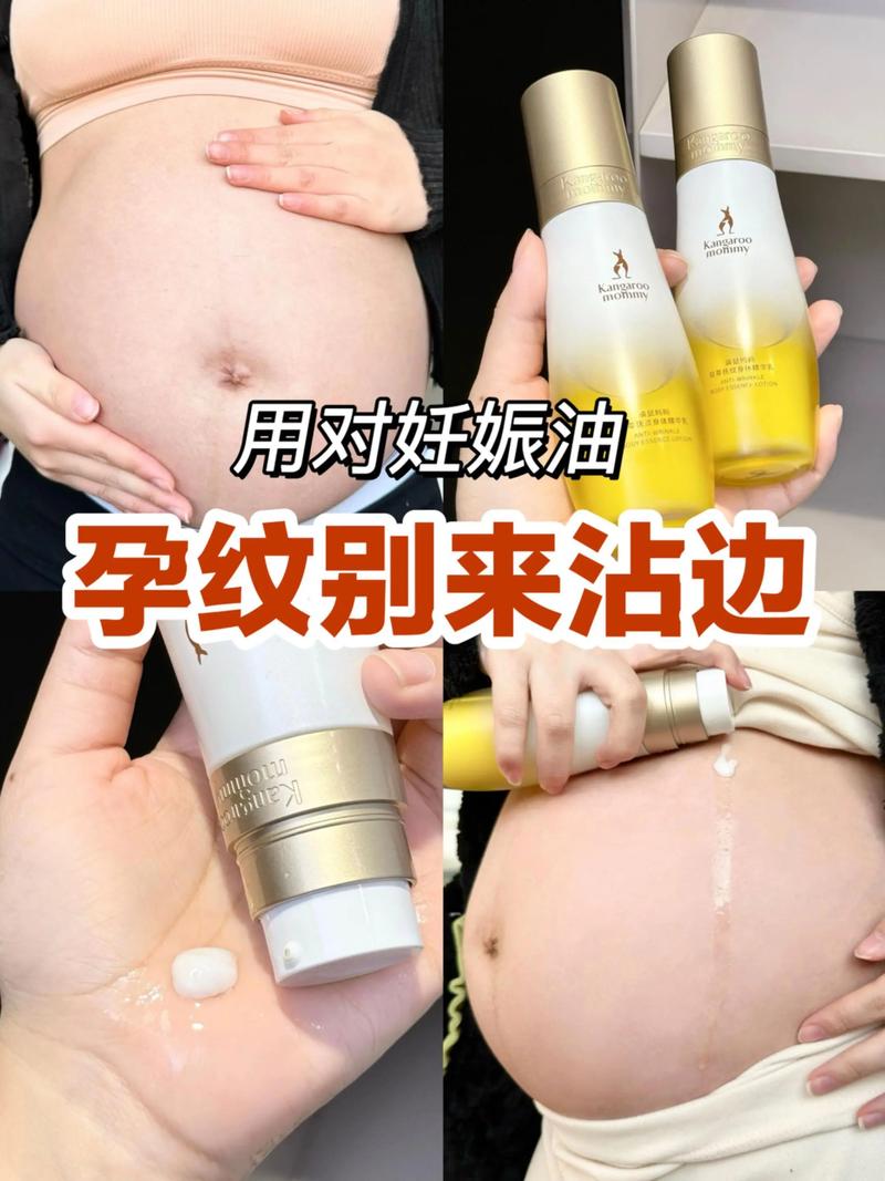 什么可以淡化妊娠纹