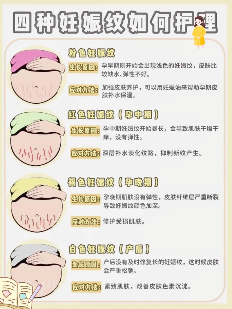 什么可以淡化妊娠纹