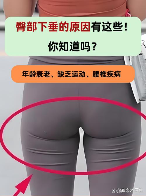 屁股为什么会下垂