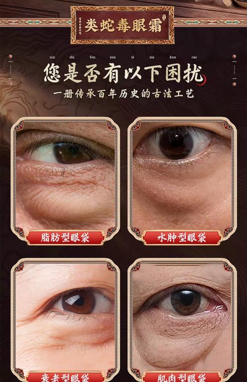 什么东西能去眼袋