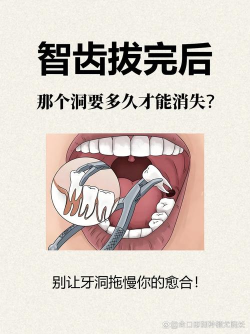 为什么拔牙要缝针