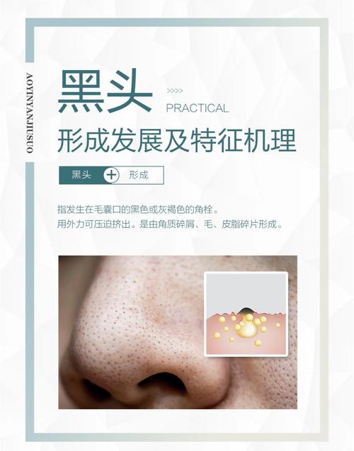为什么要长黑头