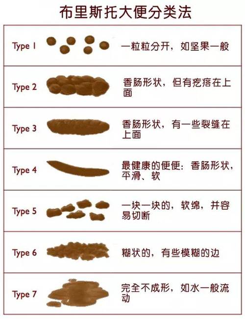 什么清宿便