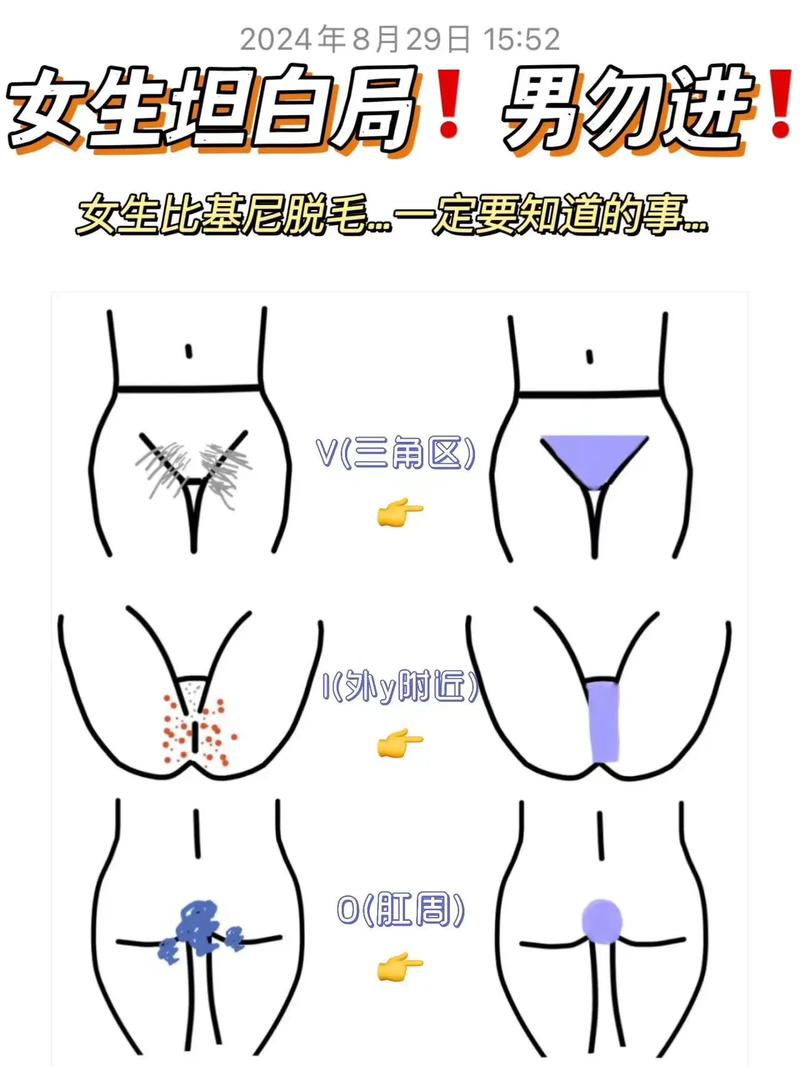 比基尼线是什么