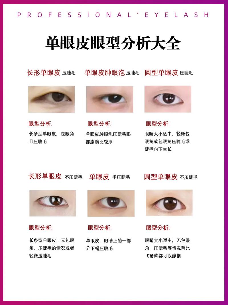眼睛为什么一单一双
