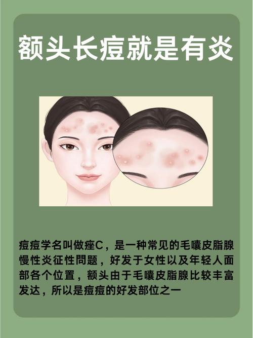 额头起痘是什么原因