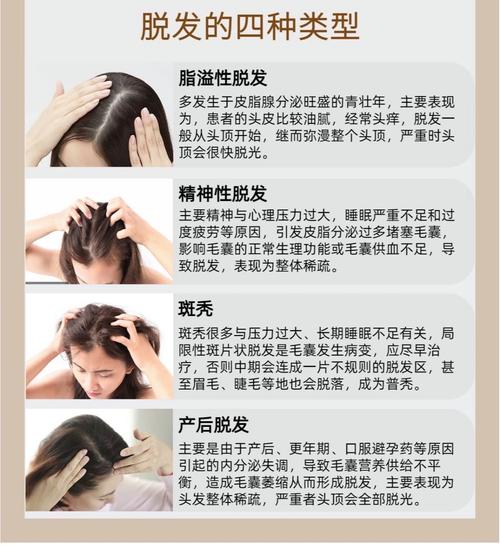 头发掉的原因是什么