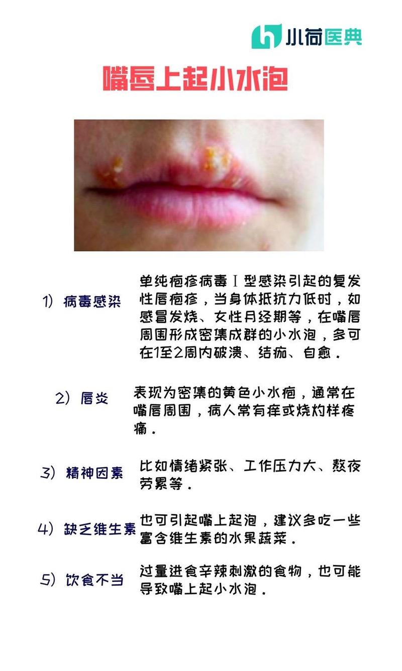 嘴唇上长泡什么原因