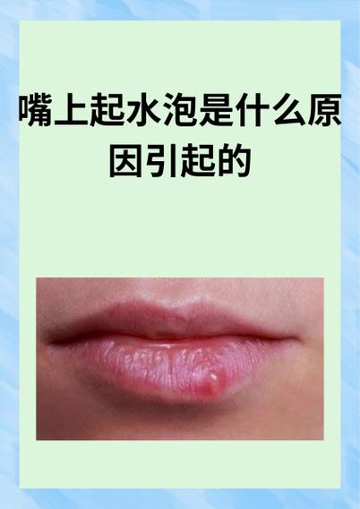 嘴唇上长泡什么原因