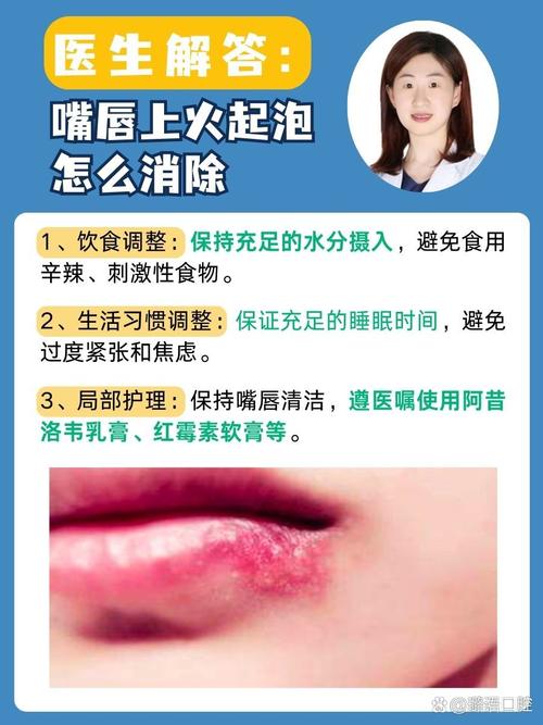 嘴唇上长泡什么原因