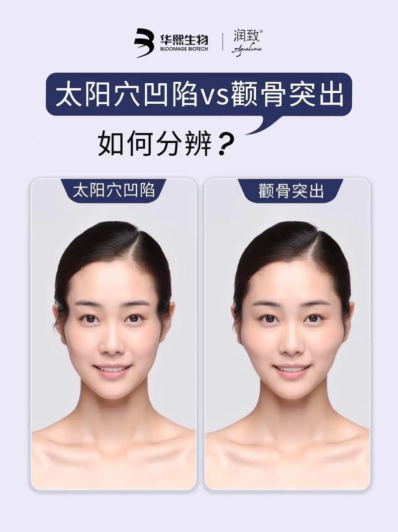 颧骨突出是什么原因