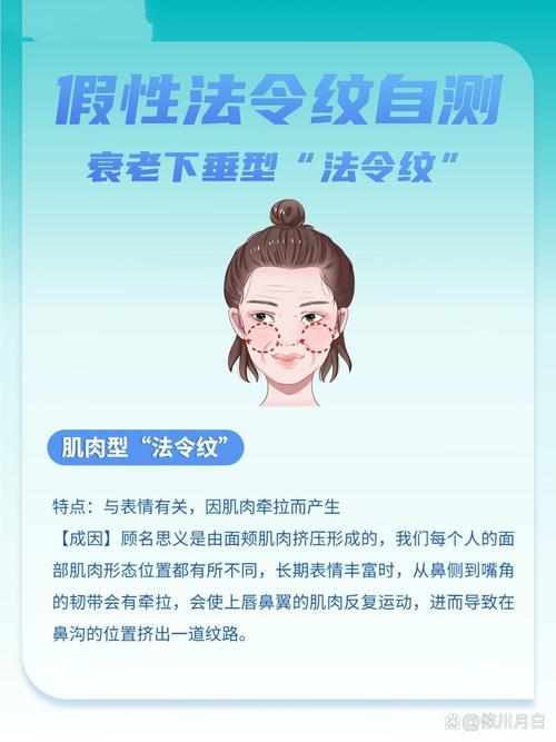为什么出现法令纹