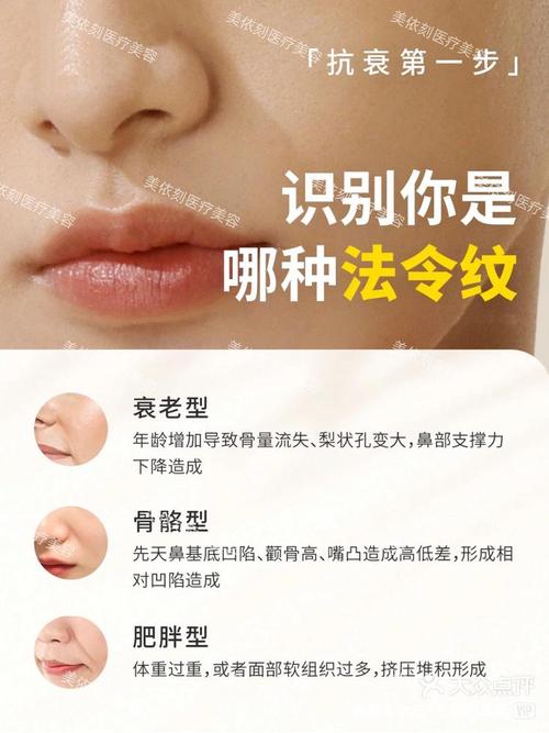 为什么出现法令纹