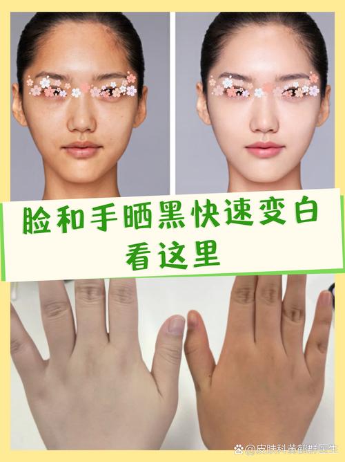 为什么手比脸黑
