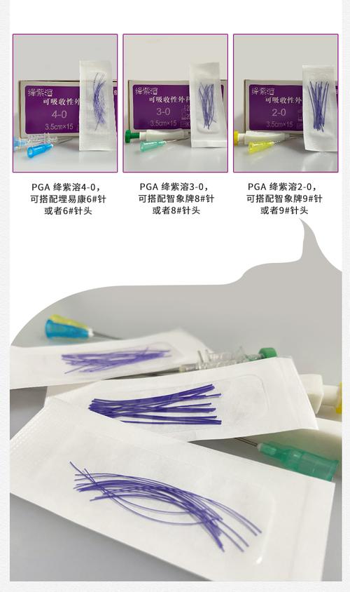 埋线减肥的用什么线