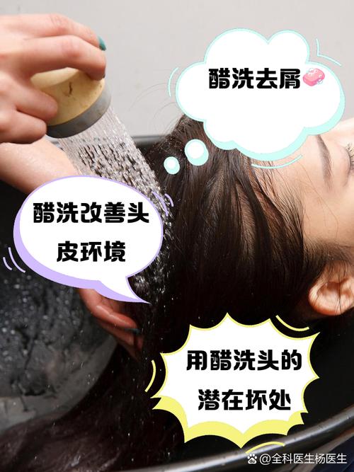 洗头用什么醋最好