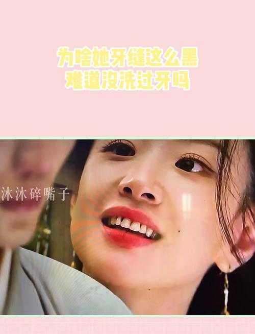 为什么牙缝会变黑