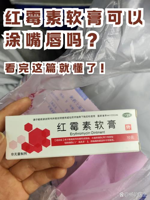 嘴唇起泡抹什么药膏