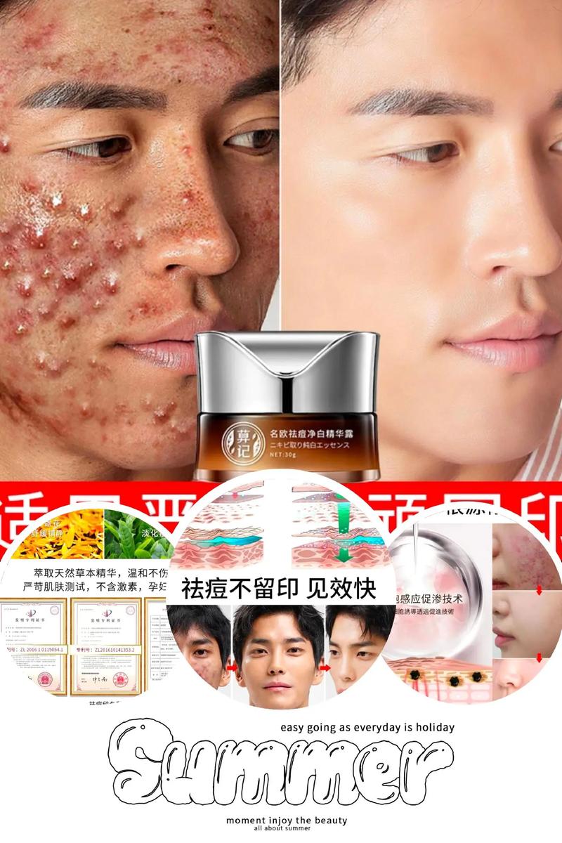 用什么可以淡化痘印