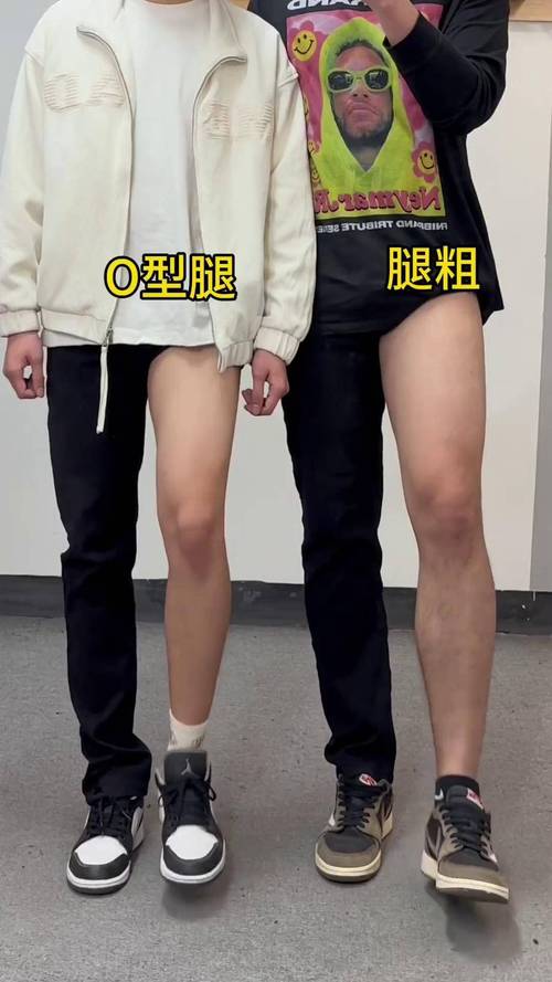 矮小o型腿怎么穿衣搭配
