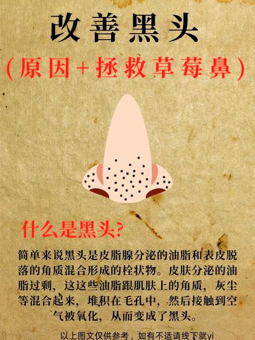 为什么鼻子会长黑头